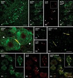 MUPP1 Antibody in Immunohistochemistry (IHC)