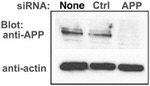 beta Amyloid Antibody in Western Blot (WB)