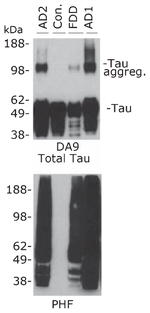 beta Amyloid Antibody in Western Blot (WB)