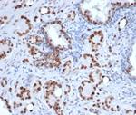 Androgen Receptor Antibody in Immunohistochemistry (Paraffin) (IHC (P))