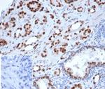 Androgen Receptor Antibody in Immunohistochemistry (Paraffin) (IHC (P))