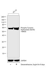 Phospho-Tyrosine Hydroxylase (Ser40) Antibody in Western Blot (WB)