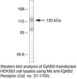 EphB2 Antibody in Western Blot (WB)