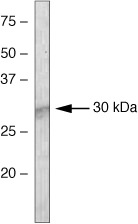 SOCS1 Antibody in Western Blot (WB)