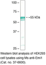 FBXO5 Antibody in Western Blot (WB)