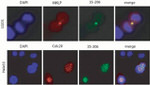 PLK1 Antibody in Immunocytochemistry (ICC/IF)