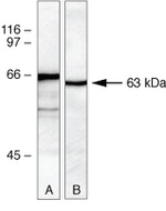 PLK1 Antibody in Western Blot (WB)