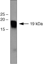 p19 INK4d Antibody in Western Blot (WB)