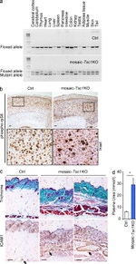 TSC1 Antibody in Immunohistochemistry (IHC)