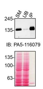 TSC1 Antibody in Immunoprecipitation (IP)