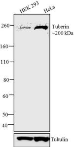 TSC2 Antibody in Western Blot (WB)