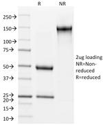 Involucrin (Squamous Cell Terminal Differentiation Marker) Antibody in SDS-PAGE (SDS-PAGE)