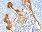 Involucrin (Squamous Cell Terminal Differentiation Marker) Antibody in Immunohistochemistry (Paraffin) (IHC (P))