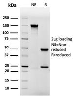 Involucrin Antibody in SDS-PAGE (SDS-PAGE)