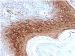 Involucrin Antibody in Immunohistochemistry (Paraffin) (IHC (P))