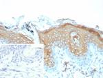 Involucrin (Squamous Cell Terminal Differentiation Marker) Antibody in Immunohistochemistry (Paraffin) (IHC (P))