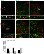 EphA4 Antibody in Immunocytochemistry (ICC/IF)