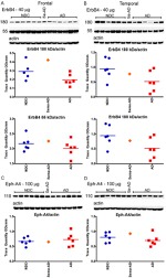 EphA4 Antibody in Western Blot (WB)