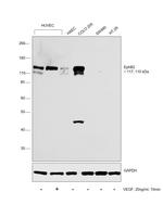 EphB2 Antibody in Western Blot (WB)