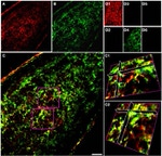 NG2 Antibody in Immunohistochemistry (IHC)