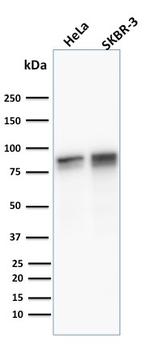 Catenin, gamma (Cardiomyocyte Marker) Antibody in Western Blot (WB)