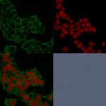 Catenin, gamma (Cardiomyocyte Marker) Antibody in Immunocytochemistry (ICC/IF)