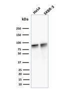 Catenin, gamma (Cardiomyocyte Marker) Antibody in Western Blot (WB)