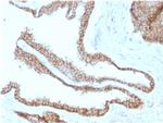 Catenin, gamma Antibody in Immunohistochemistry (Paraffin) (IHC (P))