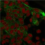 Catenin, gamma (Cardiomyocyte Marker) Antibody in Immunocytochemistry (ICC/IF)