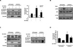 BTRC Antibody in Western Blot (WB)