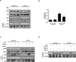 BTRC Antibody in Western Blot (WB)