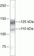 beta Amyloid (N-terminal) Antibody in Western Blot (WB)