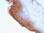 Suprabasin (SBSN) (CALB1) Antibody in Immunohistochemistry (Paraffin) (IHC (P))