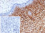 Suprabasin (SBSN) (CALB1) Antibody in Immunohistochemistry (Paraffin) (IHC (P))