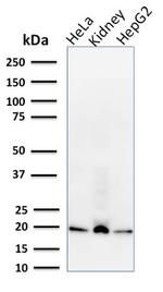 ARF1 (Golgi Apparatus Marker) Antibody in Western Blot (WB)