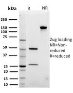 ARF1 (Golgi Apparatus Marker) Antibody in SDS-PAGE (SDS-PAGE)