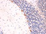 ARF1 (Golgi Apparatus Marker) Antibody in Immunohistochemistry (Paraffin) (IHC (P))