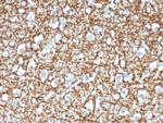 ARF1 (Golgi Apparatus Marker) Antibody in Immunohistochemistry (Paraffin) (IHC (P))