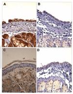 Nectin 1 Antibody in Immunohistochemistry (IHC)