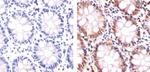 PLK1 Antibody in Immunohistochemistry (Paraffin) (IHC (P))