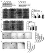 HSP90 beta Antibody in Western Blot (WB)