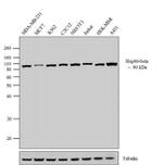 HSP90 beta Antibody in Western Blot (WB)