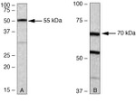 PKC zeta Antibody in Western Blot (WB)