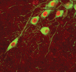 PITX3 Antibody in Immunohistochemistry (IHC)