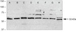 c-Fos Antibody in Western Blot (WB)