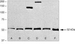 SMAD1 Antibody in Western Blot (WB)