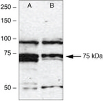 IRAK1 Antibody in Western Blot (WB)