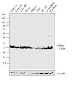 PGP9.5 Antibody in Western Blot (WB)