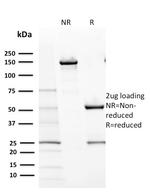 CD117/c-Kit (Marker for Gastrointestinal Stromal Tumors) Antibody in SDS-PAGE (SDS-PAGE)