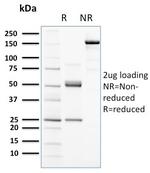 CD117/c-Kit (Marker for Gastrointestinal Stromal Tumors) Antibody in SDS-PAGE (SDS-PAGE)